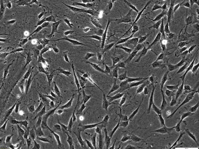 Amnion MSCs in culture on CELLvo™ Matrix (100x)